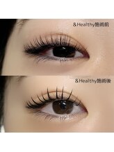 トレース(tres)/バインドロック　&healthy