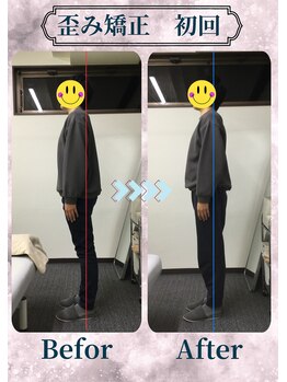 アミーゴ整体院/ビフォーアフター