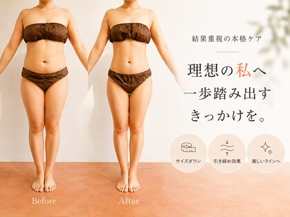 エープラス(A+)の写真