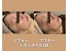 【小顔・二重あご】レモンボトル3cc+リンパ 60分 ¥9900