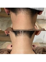 リエル(Reyel)/襟足脱毛　剃毛付★