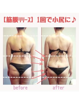 ビューティサロン キヨの部屋(beauty salon)/【筋膜リリース】　１回