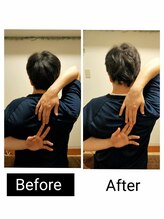 アース エンジェル整体院/ビフォアフ　肩甲骨はがし