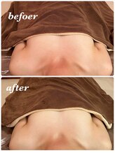 シャルマン(Charmant)/デコルテからバストアップ！！