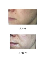 サロン リノ(salon rino)/