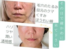 アガル(agaru)の雰囲気（＜月イチ９０分＞最強4ステップのたるみアガル肌活 体験受付中！）