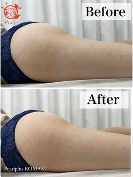 パールプラス 小牧店(Pearl plus)/BeforeAfter