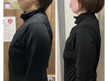 ヨサパーク ルポ(YOSA PARK ropos)/ルルオン4ヶ月の変化!