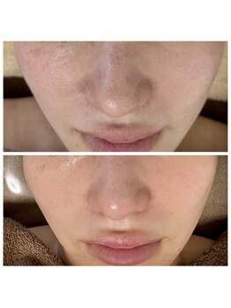 ジャスミン(Jasmine)/