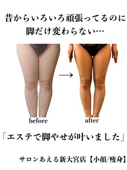 サロンあえる 新大宮店/いろいろ頑張ってるのに脚だけ…
