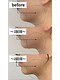 ベル(BELL)の写真/SNSで話題の韓国美容【小顔オンダウェーブ｜8,980円★】"結果重視"の超最新施術でたった一度でも効果実感◎