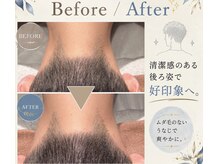 エッセンシャル 南海難波店(ESSENTIAL)の雰囲気（【うなじ脱毛】清潔感のある後ろ姿で好印象へ♪）