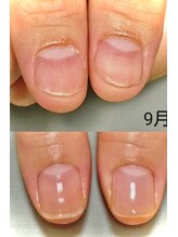 リヒネイル(Rihi.nail)/自爪育成