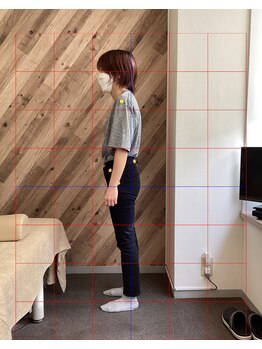 鷺沼駅前整骨院 鍼灸マッサージ院/姿勢矯正