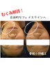 老け顔改善・骨格小顔矯正　90分¥11000→¥8000