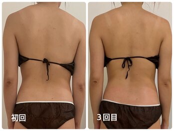 ナビ(NABI)/筋膜リリースで痩せ体質に