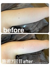 ギンザアール(GINZA R.)/挙式前の花嫁様にオススメ♪