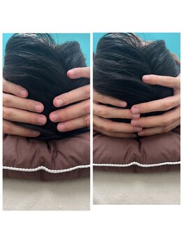 堺整骨院 小郡院/小顔矯正