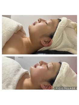 BBC 田園調布/小顔コルギ効果