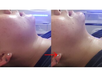 エクラ(e'clat)/横顔のラインがでました★