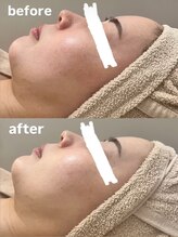 フェリノ(FERINO)/エンビロンでトーンアップ