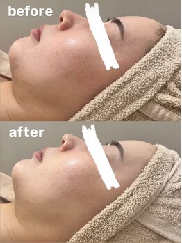 フェリノ(FERINO)/エンビロンでトーンアップ