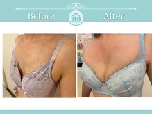 美人バスト 浜松店/◇ バストアップ &nbsp;BeforeAfter◇