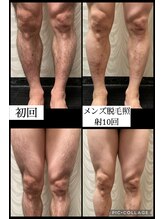 ナムズ(Nams)/ビフォーアフター