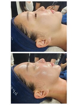 フローラル ビューティー(Floral-Beauty)/韓国☆『スーパージェクション』