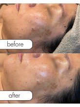 アール(R;)/ビタミンが効きやすい肌造り