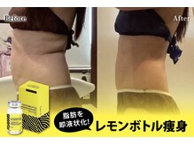 アネル 新都心店(anel)