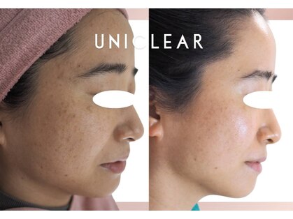 ユニクリア(Uni clear)の写真