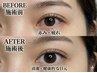 【眼精疲労・スマホ疲れ】 ホワイトニング眼球志筋術60分9900円
