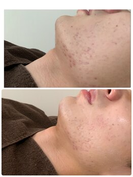 エスポワール(Espoir)/