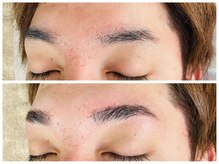 ブリリアン/結婚式はハリウッドブロウで