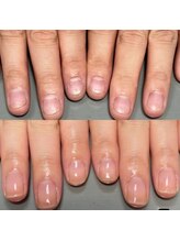 リヒネイル(Rihi.nail)/自爪育成