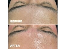 ベレア(BELEA)/メンズも可能◎