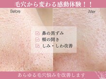 モアビューティー 庚午店(MORE BEAUTY)