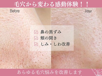 モアビューティー 庚午店(MORE BEAUTY)の写真
