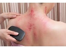 シュガーリングハウスレディ(SugaringHouse LADY)の雰囲気(体に優しい天然素材の水牛角を使用したかっさで老廃物の排出促進)