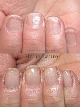 マリーロール 梅田店(Marie Laure)/深爪改善/自爪育成/ネイルケア