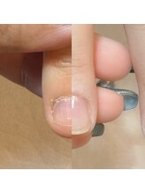 ロータス(LOTUS)/育成３回目の奇跡☆