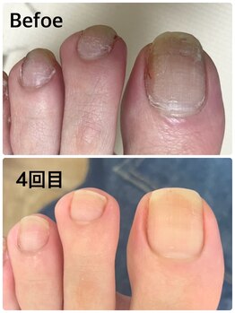 グラティアラ 銀座の写真/健康的な美爪に◎[初回肌爪カウンセリング&爪を育てるフットケア(爪の形整え,甘皮お手入れ)¥12100】]