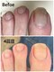 グラティアラ 銀座の写真/健康的な美爪に◎[初回肌爪カウンセリング&爪を育てるフットケア(爪の形整え,甘皮お手入れ)¥12100】]