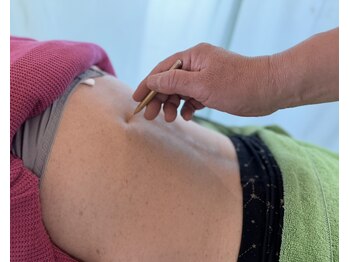 上田鍼灸治療院/○腰痛の痛み○