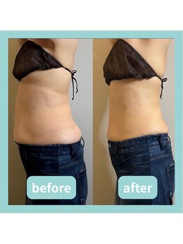 セメ(S’aimer)の写真/結果に自信あり◎本気の全身痩身ダイエット！短期集中で理想のボディラインを目指しませんか？