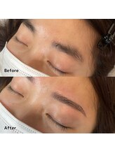 ビトタン 倉敷本店(+美to鍛)/太くて濃い眉毛がコンプレックス