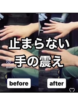 カワル整体 上通り院/止まらない手の震え