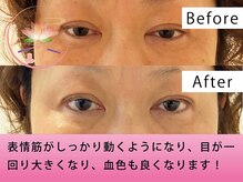 健美庵/本格美容鍼