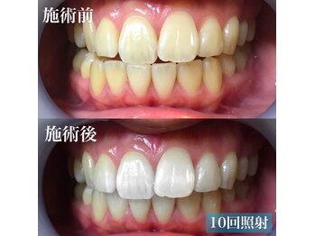 LBSホワイトニング 上野店